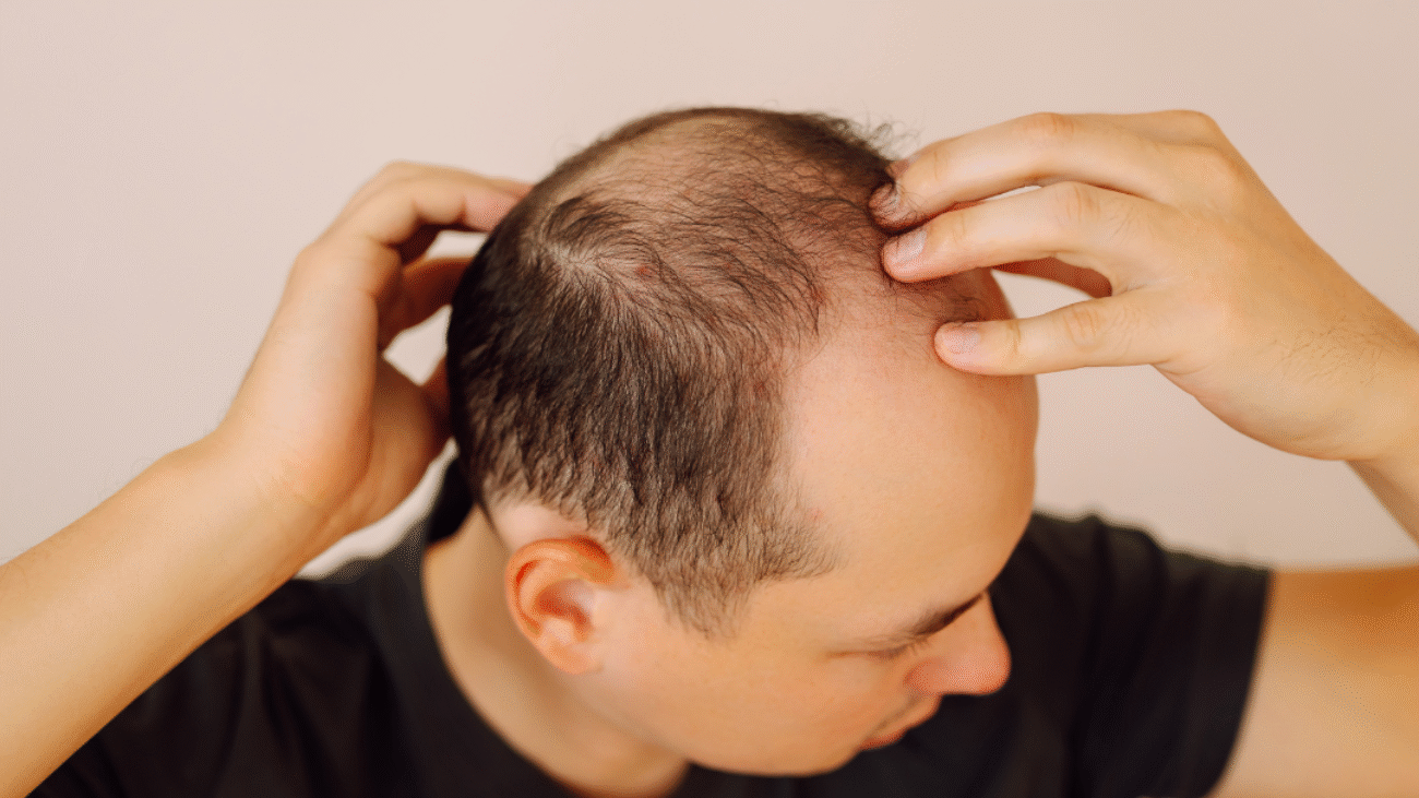 Questions To Ask During Your First Visit With a Dermatologist